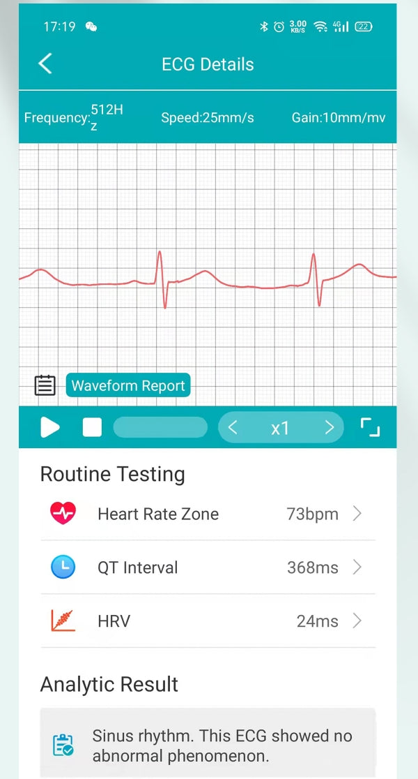 La montre intelligente BCE400 utilise un capteur intégré pour suivre l'état de santé en temps réel, avec 32 types de dépistage des maladies ECG, un ECG AI intelligible, prend en charge le rapport de santé de lecture ECG, fournit un rapport de diagnostic ECG intuitif et précis, voit intuitivement les maladies et les risques potentiels, donc que vous pouvez connaître votre santé à tout moment et n'importe où.