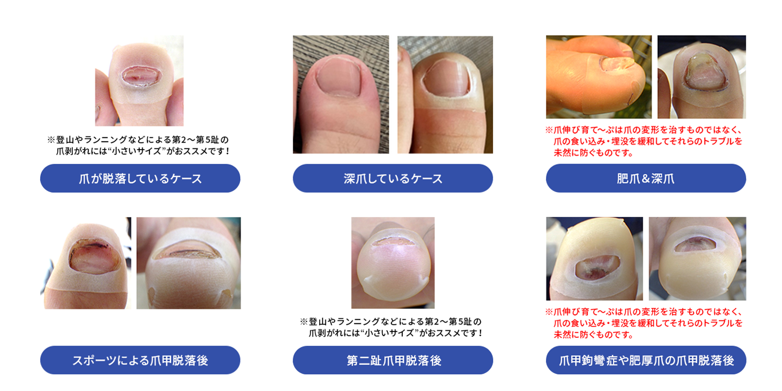 爪伸び育て~ぷ使用例