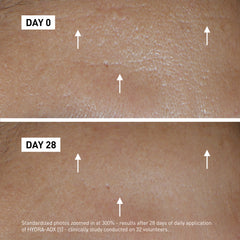 Get younger-looking skin in 7 days with HYDRA-AOX [5]