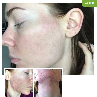  Before and after images of an Exposed customer.