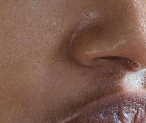 A close-up shot of oily skin.