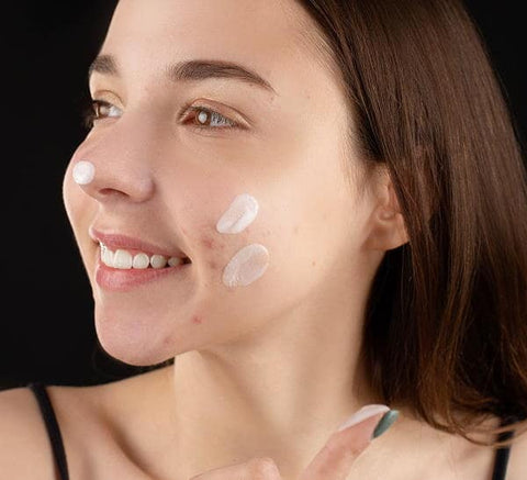 A woman with acne cream on her blemishes.