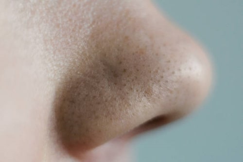 Close up of nose full of blackheads