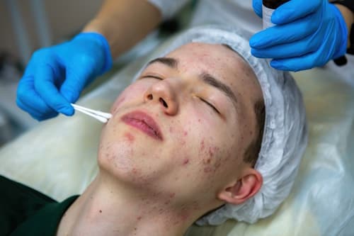Man with severe acne being tested