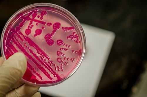Bacterial culture plate showing antibiotic resistance