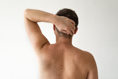 Male back skin