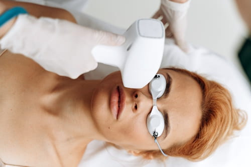 Woman getting face laser treatment
