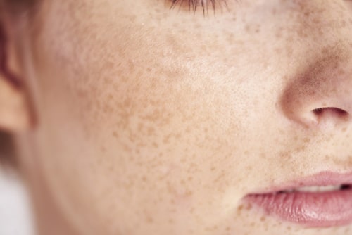 Close up of woman freckles