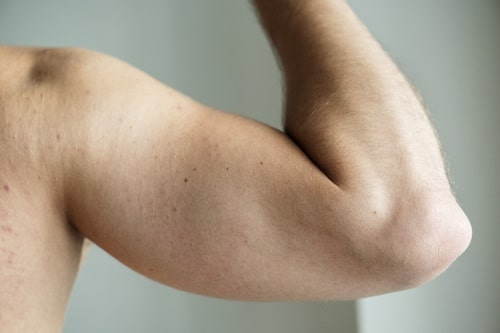 Image of a man's arm