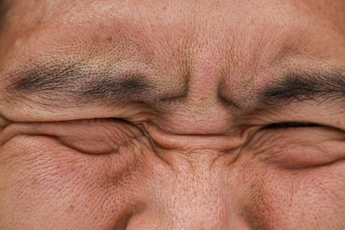 Close up of man with oliy forehead