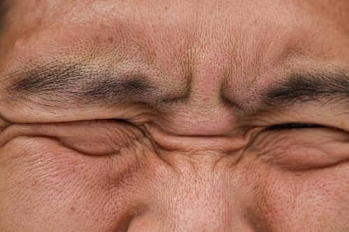 Person's oily forehead closed up