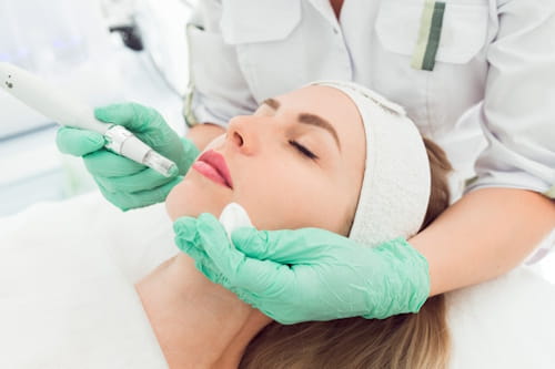 Microneedling treatment done on woman