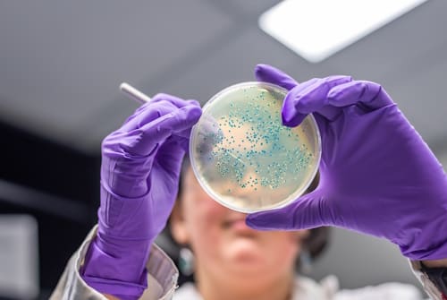 Petri dish with bacterial culture