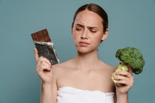 Ginger woman with pimples posing with chocolate and brocolli