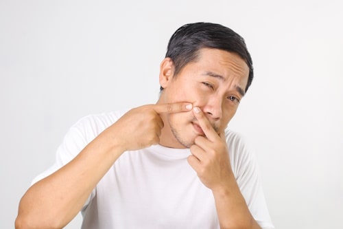 Image of asian man picking on his acne