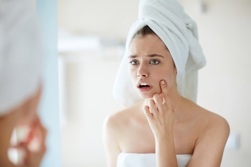 Woman with towel on head worried about pimple