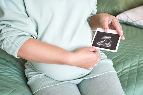 Pregnant woman holding sonogram