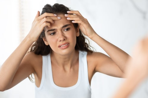 Woman worrying about acne on her forehead