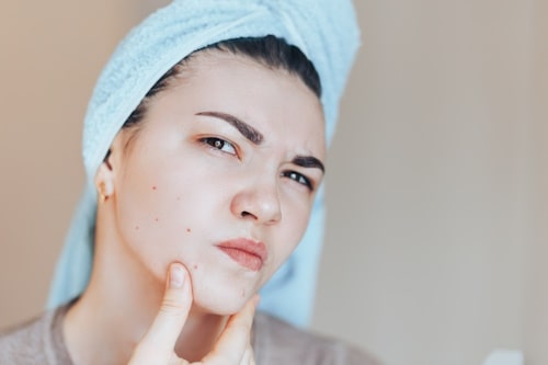 Woman with towel on her head looking at face with mirror