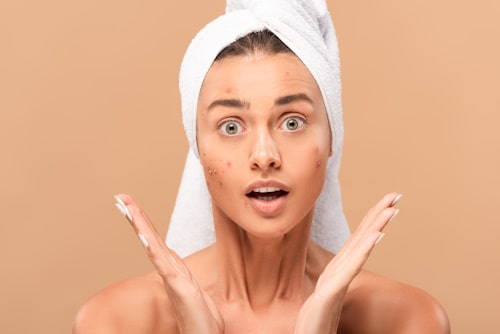 Woman with towel on head shocked with face acne