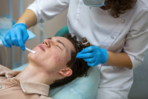 Treatment of acne in adolescents facial peeling