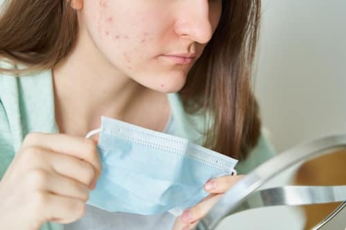 Woman holding medical mask with darkspots on her face