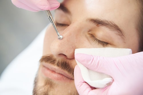 Man getting pimple popped with acne tool