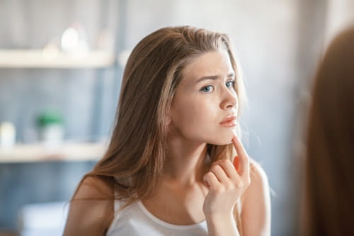 Pretty woman worried about her acne