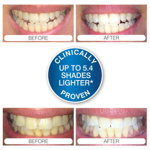 Feat Sleutel Aanpassingsvermogen Rio Smile White Advanced Blue-Light Teeth Whitening - Rio the Beauty  Specialists