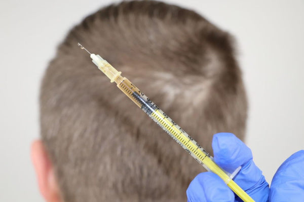 hair transplant option is worse than man's hair system