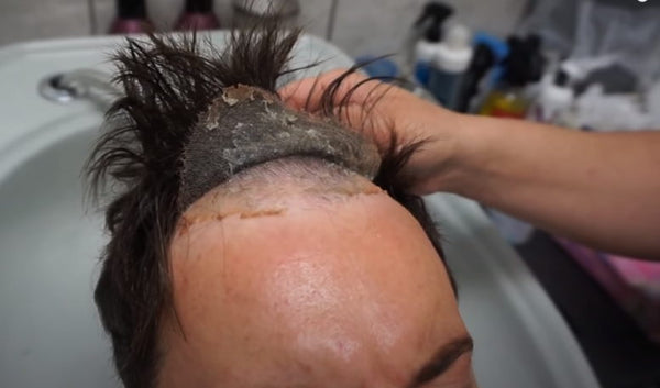 removing hair replacement system for man in torremolinos