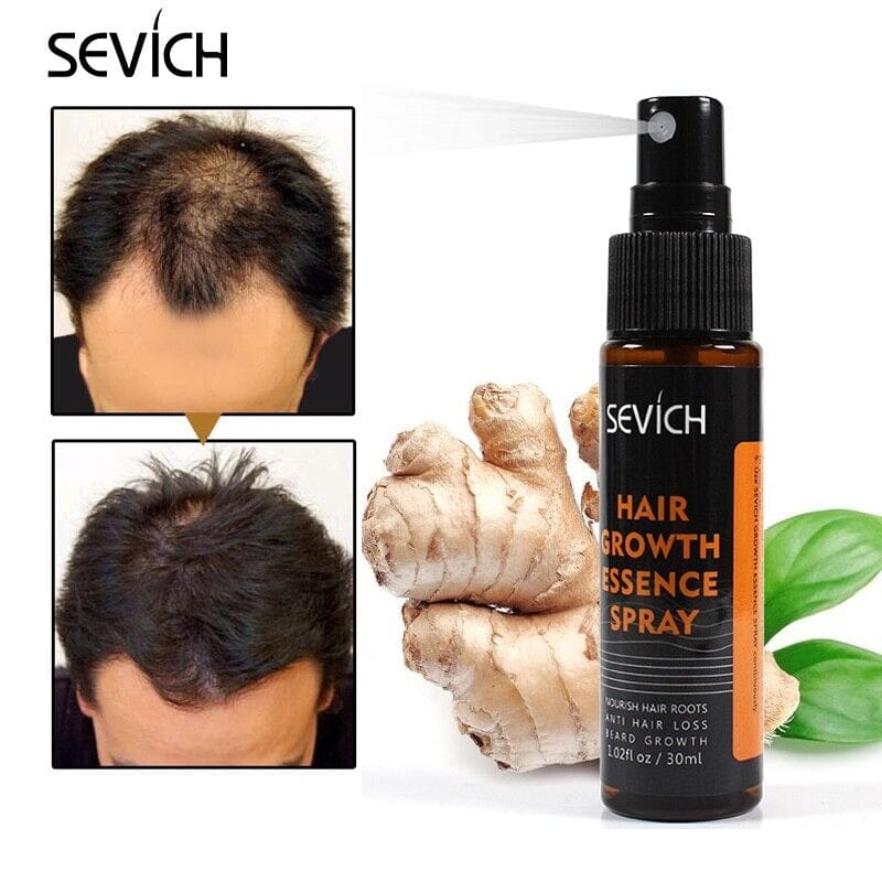 Natural Hair Growth Spray Serum AntiHair Loss Treatment Beauty Products  Herb Nourishing Scalp Lotion Hair Care For Men Women   AliExpress Mobile