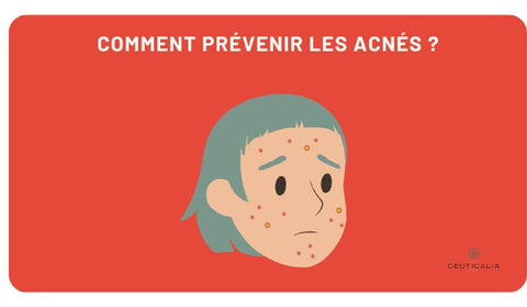 Comment prévenir les acnés ?