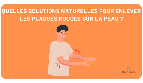 Quelles solutions naturelles pour enlever les plaques rouges sur la peau ?