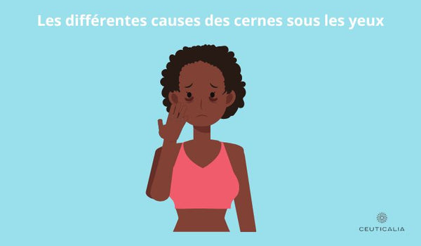 Présentation des différentes causes des cernes sous les yeux