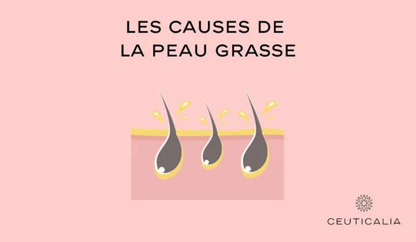 Image représentative montrant trois gouttes d'huile tombant et éclaboussant sur une surface, avec le titre 'Les causes de la peau grasse' en haut sur fond rose pâle. Logo de Ceuticalia situé en bas à droite. Visuel dédié à un article de blog de Ceuticalia discutant des différentes causes de la peau grasse