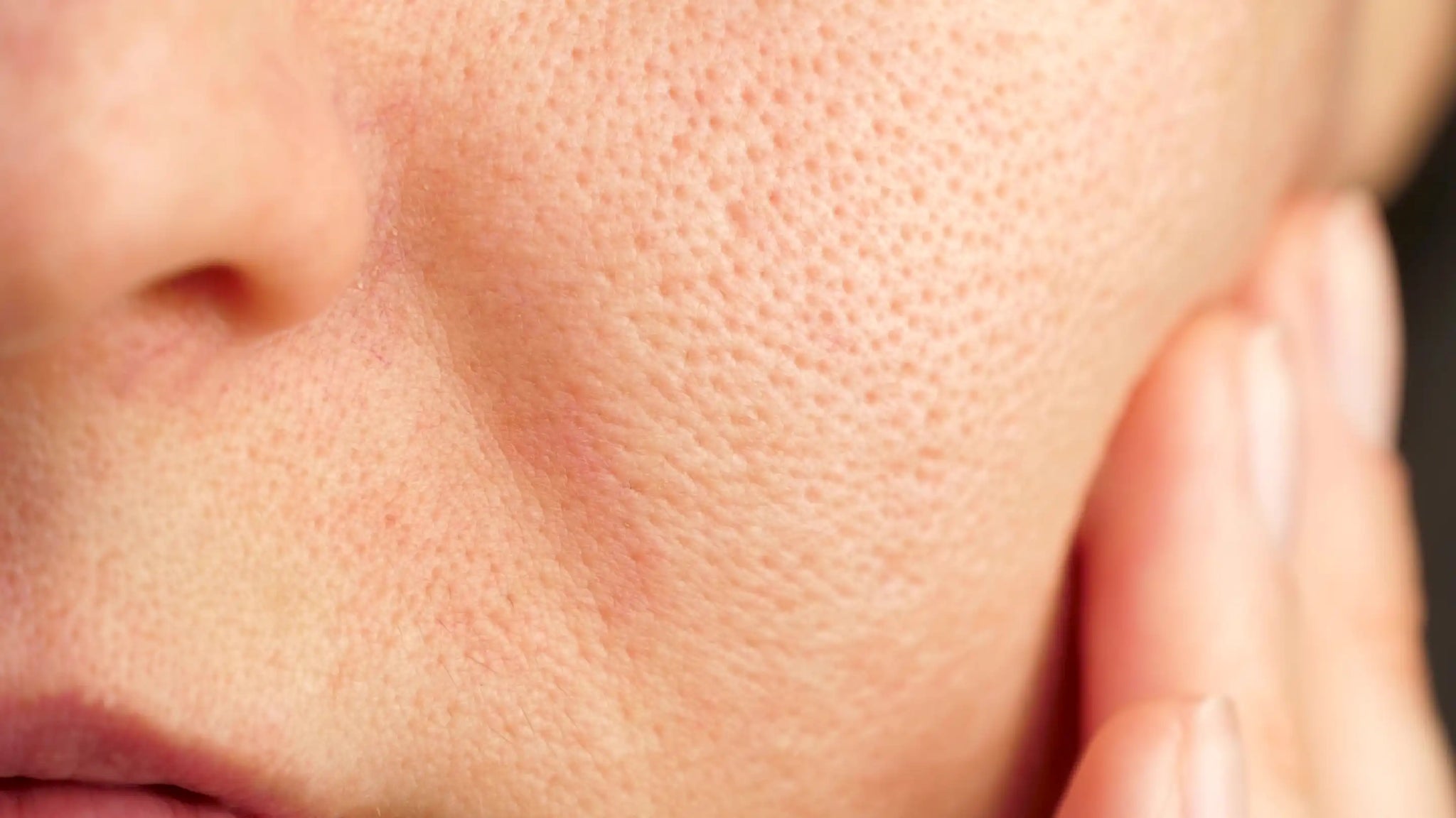 Glowing Skin - Enlarged pores