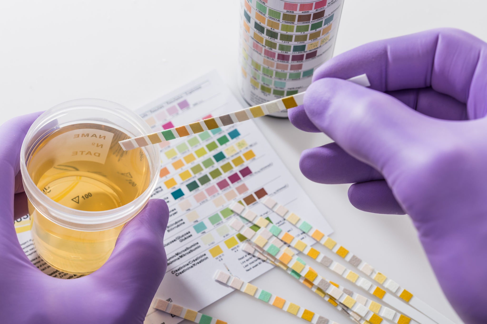 A lab technician testing urine samples.