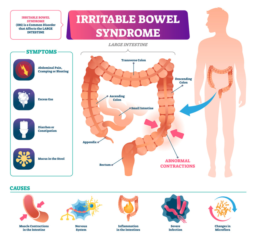 A graphical representation of the large intestine which describes IBS.