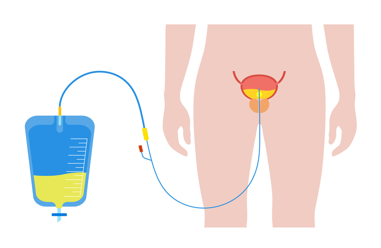 An illustration of a urinary catheter.