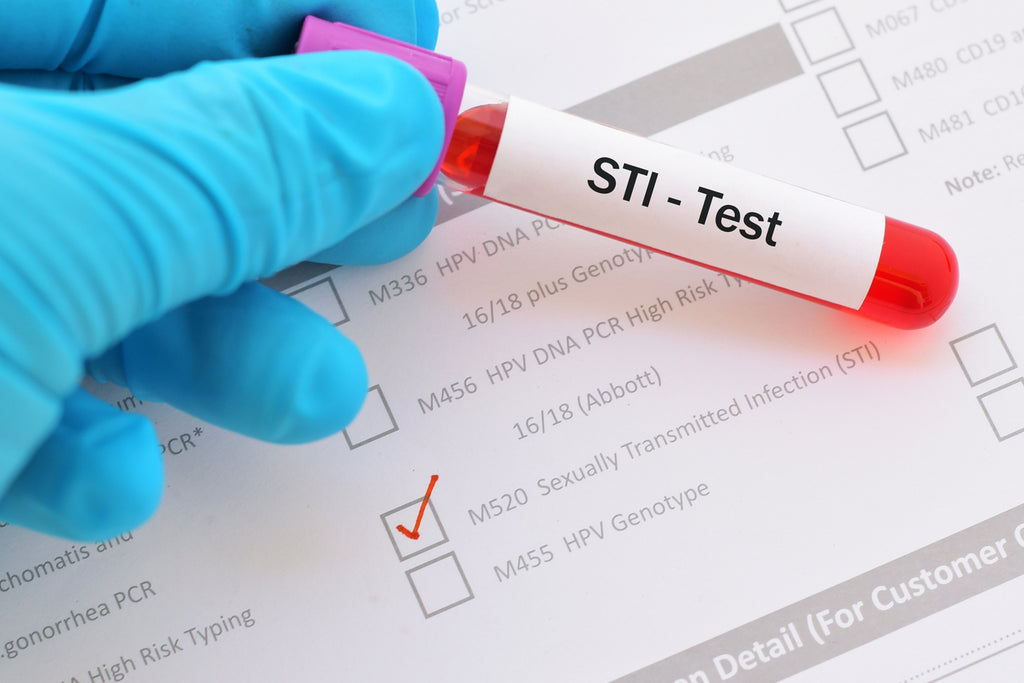 A gloved hand holds a test tube marked "STI - Test".