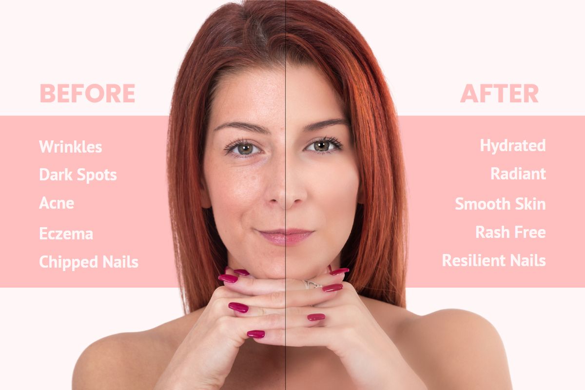Before and after comparison image showing a split view of a woman's face and nails. On the left side, the "before" image depicts wrinkles, dark spots, acne, eczema, and chipped nails. On the right side, the "after" image showcases hydrated, radiant, smooth skin, free from blemishes and eczema, and resilient, flawless nails.