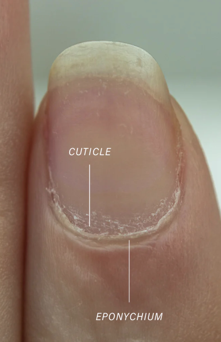 FUNGAL NAILS - Onychomycosis | Nail Infections, Causes & Treatments |  FootSmart Podiatry