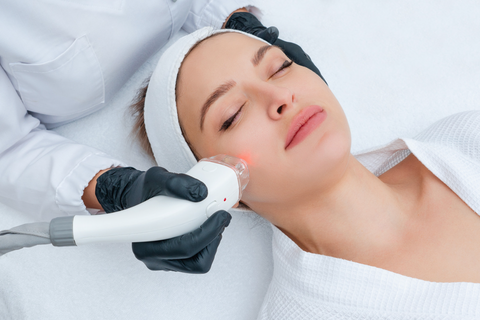 woman getting an acne laser applied to her face by aesthetician