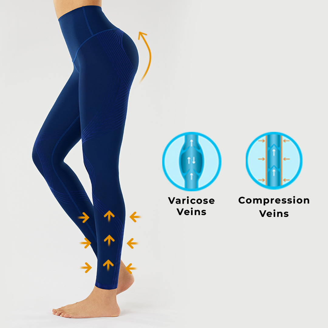 Lin Performance 20-30 mmHg Compression Socks for Women and Men Knee High  Open Toe Stockings Varicose Vein Swollen legs(L, Beige) Beige L