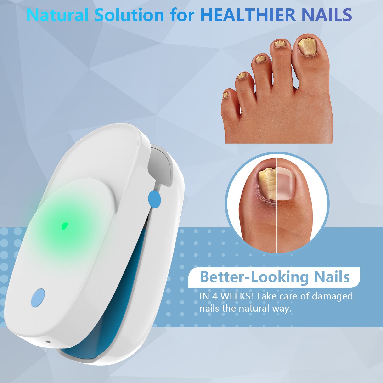 Portable Nails Fungus Laser Device Onychomycosis