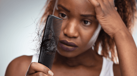 Black woman suffering from hair loss from dandruff. 