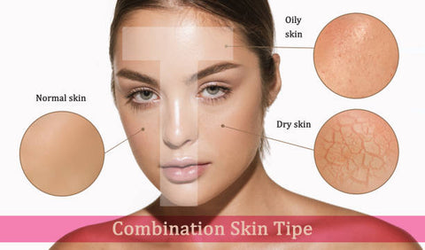 Understanding the Unique Characteristics of Combination/Mix Skin