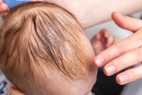 How do you identify and treat common skin conditions in babies?