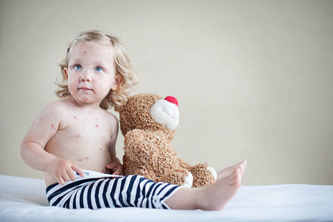 How do you identify and treat common skin conditions in babies?